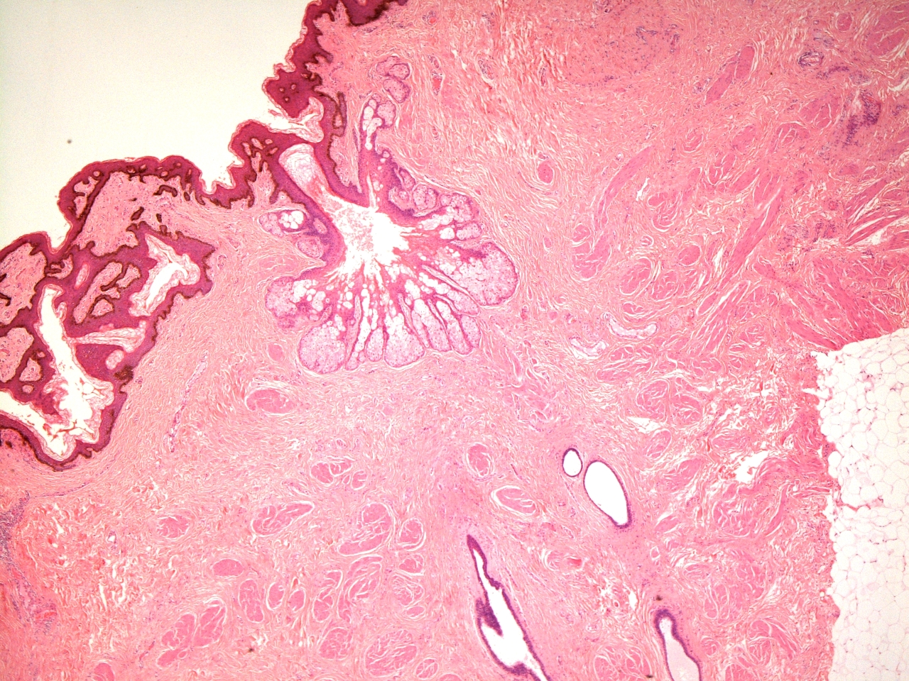 Microscopic image of the areola