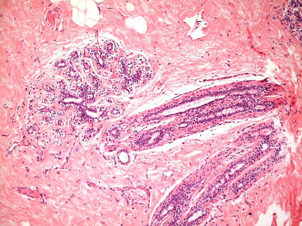 A breast duct and acinus