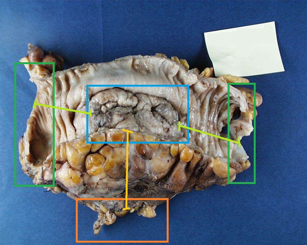 Colon labelled