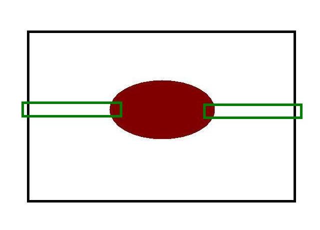 Cruciate Margin