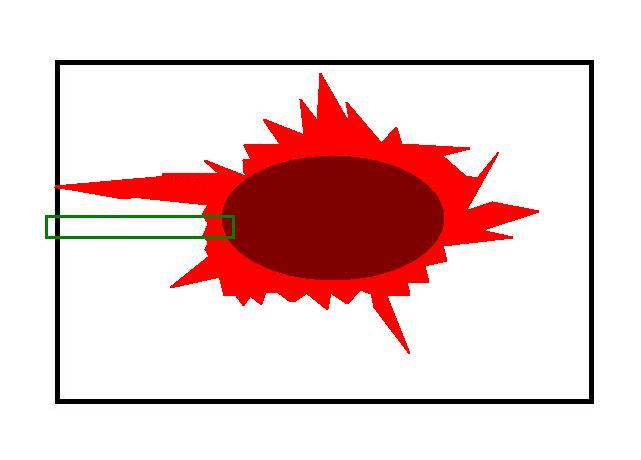 Cruciate Margin