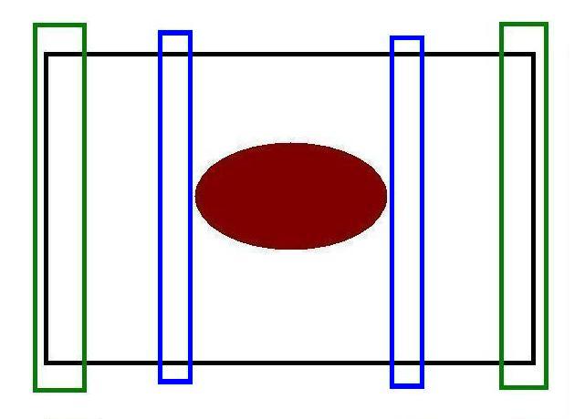 En Face Margin