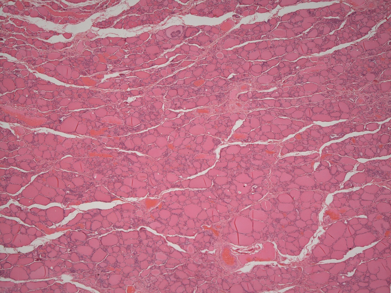 Histology of the thyroid gland