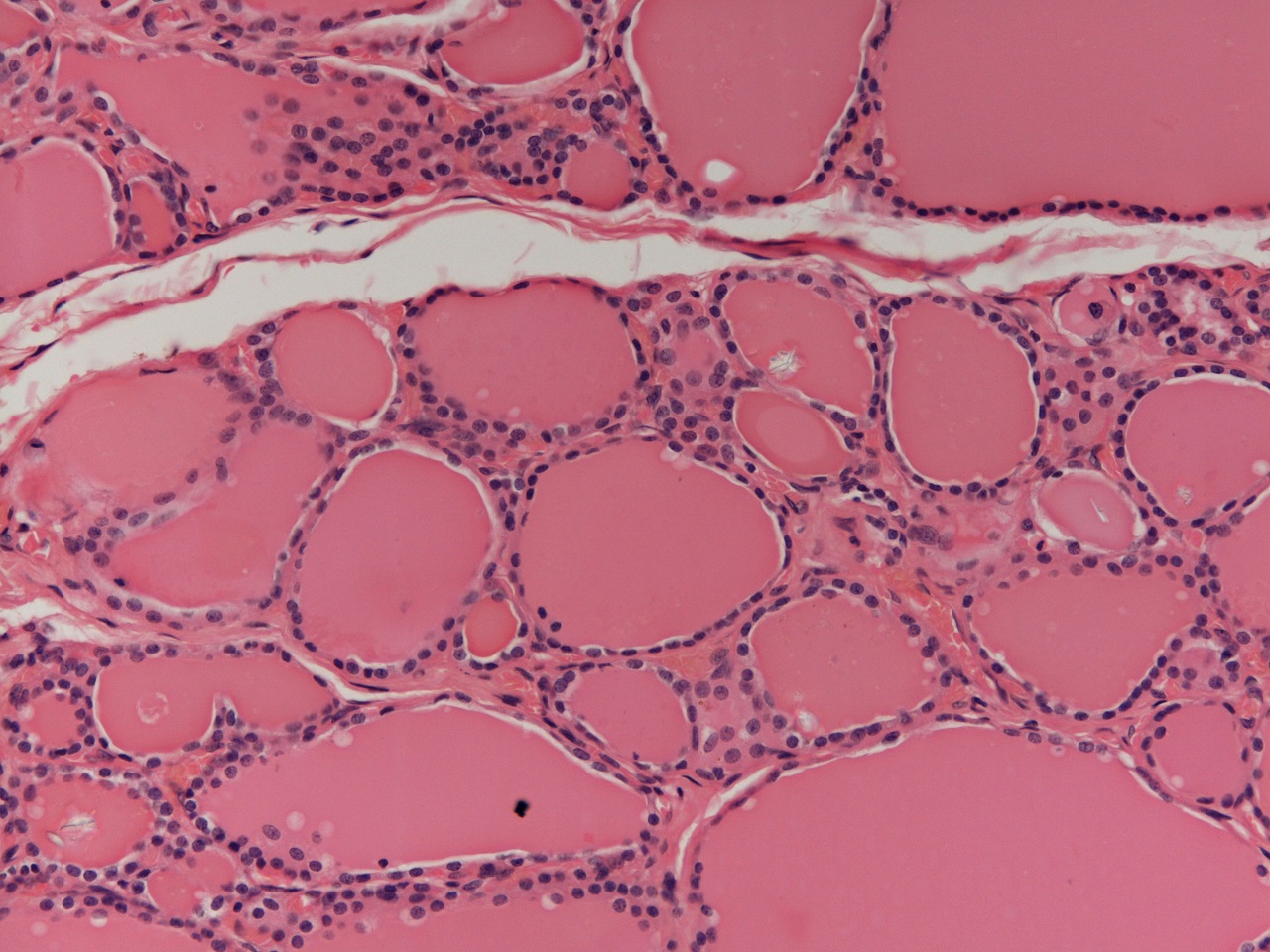 Histology of the thyroid gland