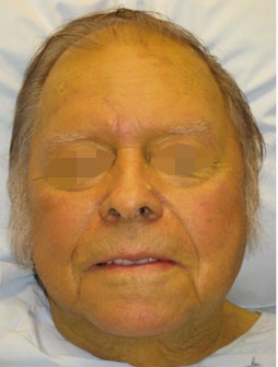 A person who has jaundice