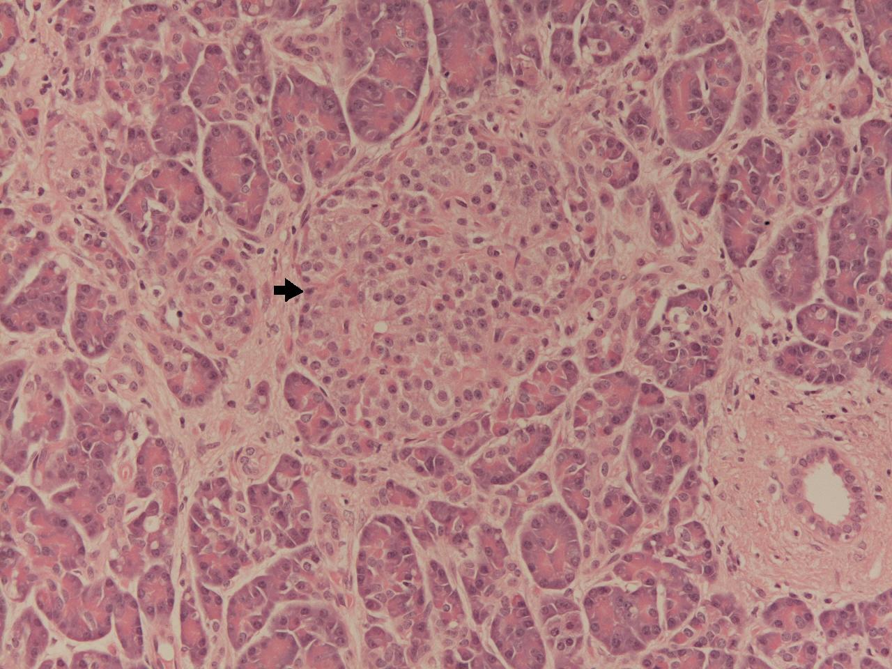 An islet of Langerhans