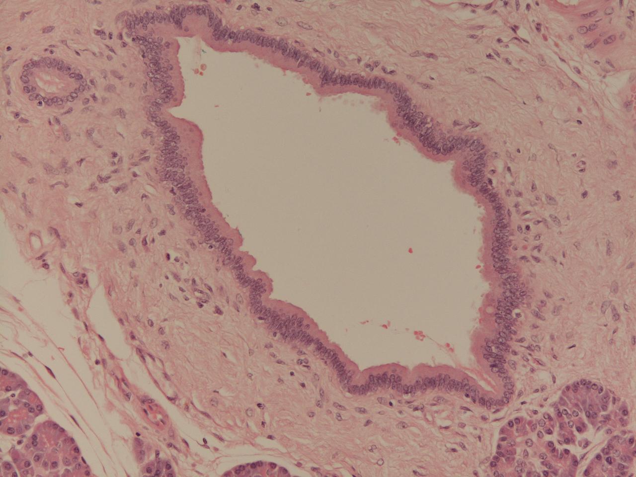 A pancreatic duct