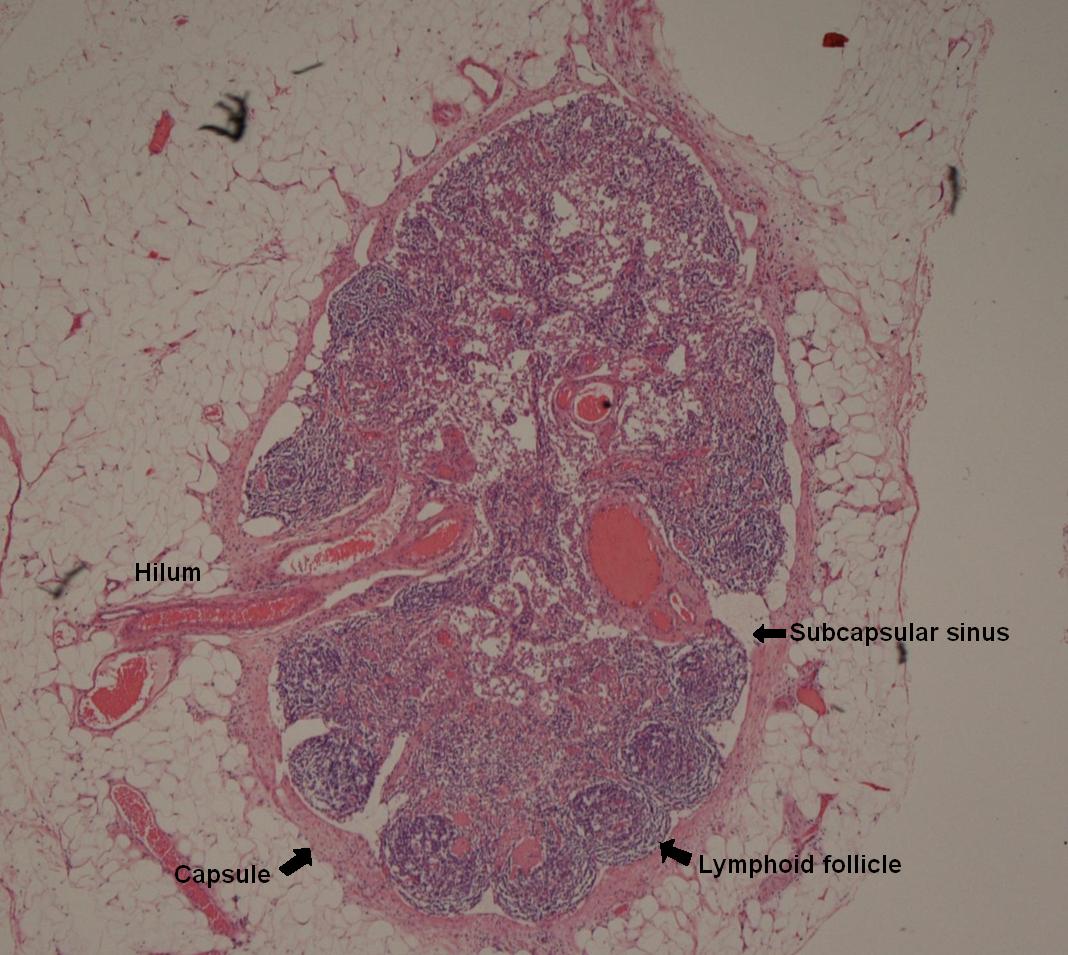 Lymph Node