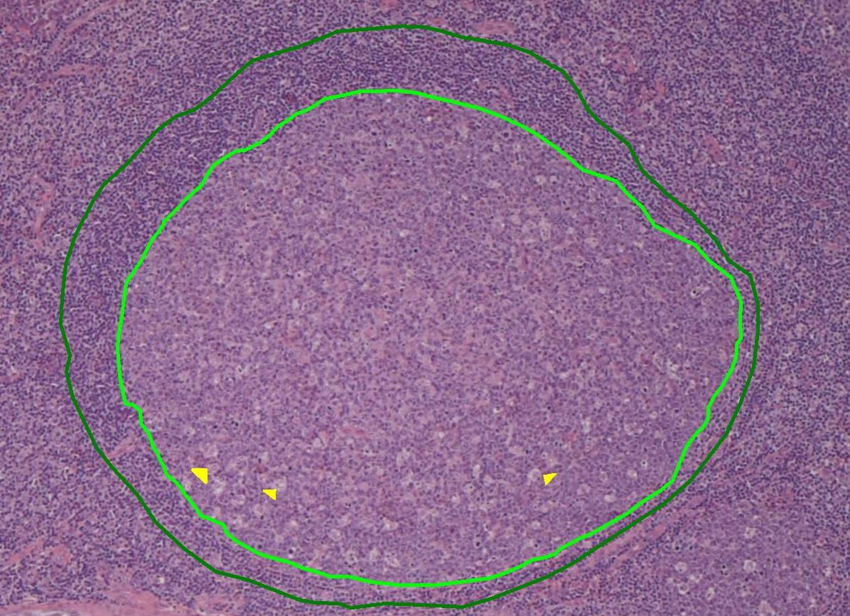 Lymphoid Follicle