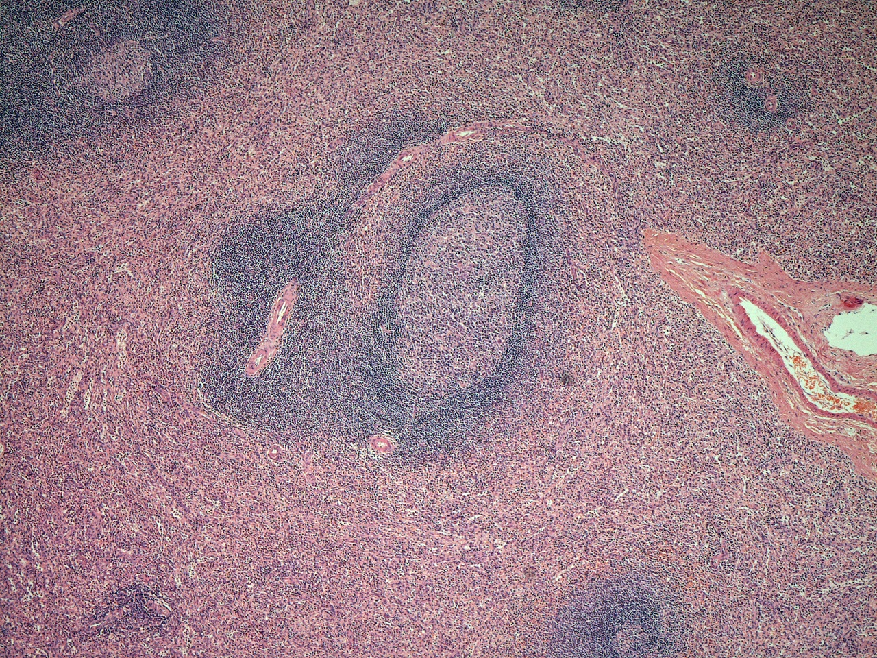 Histology of the Spleen