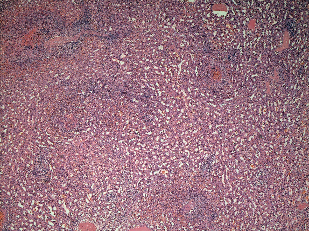 Histology of the Spleen
