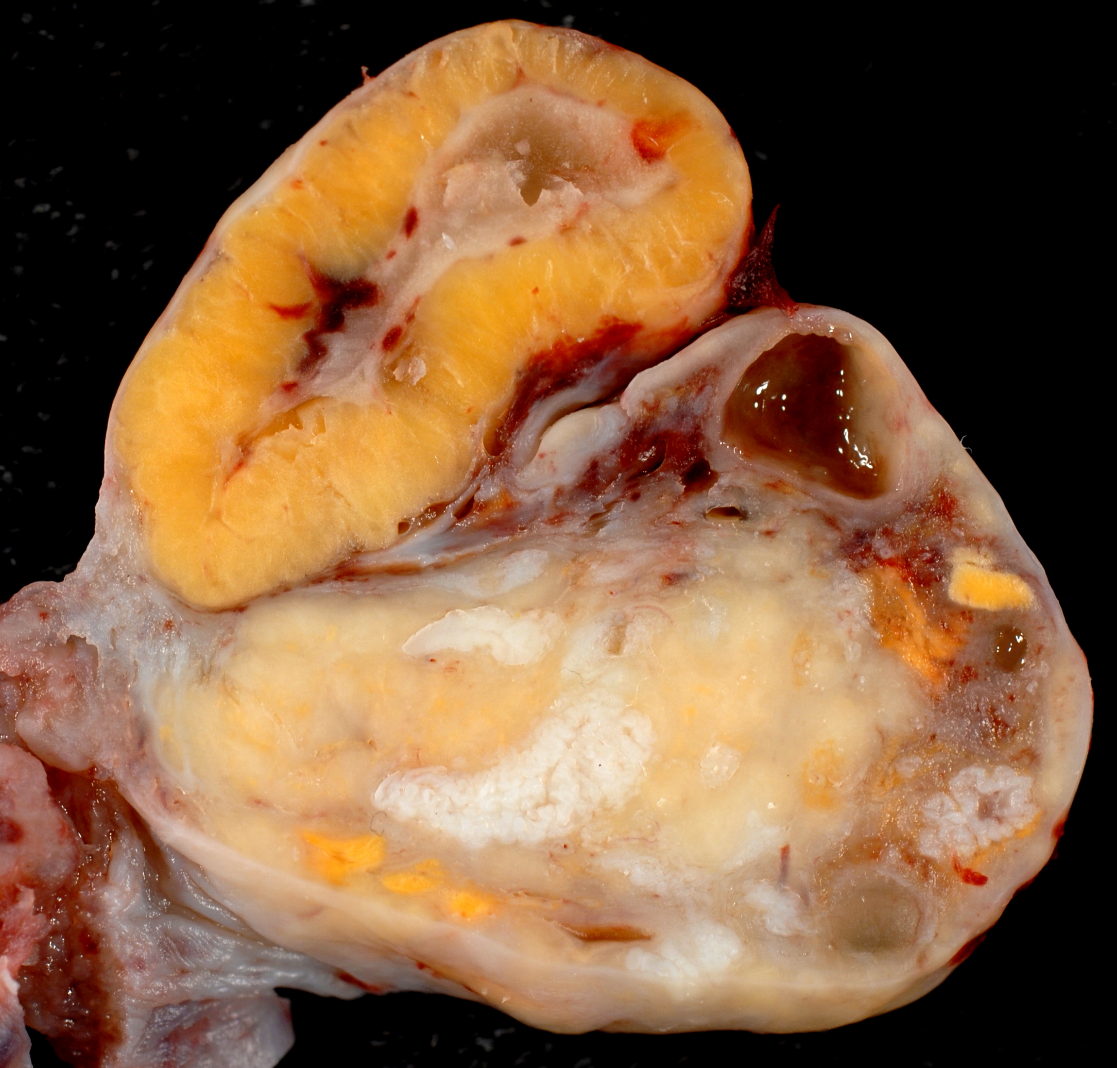 Corpus Luteum