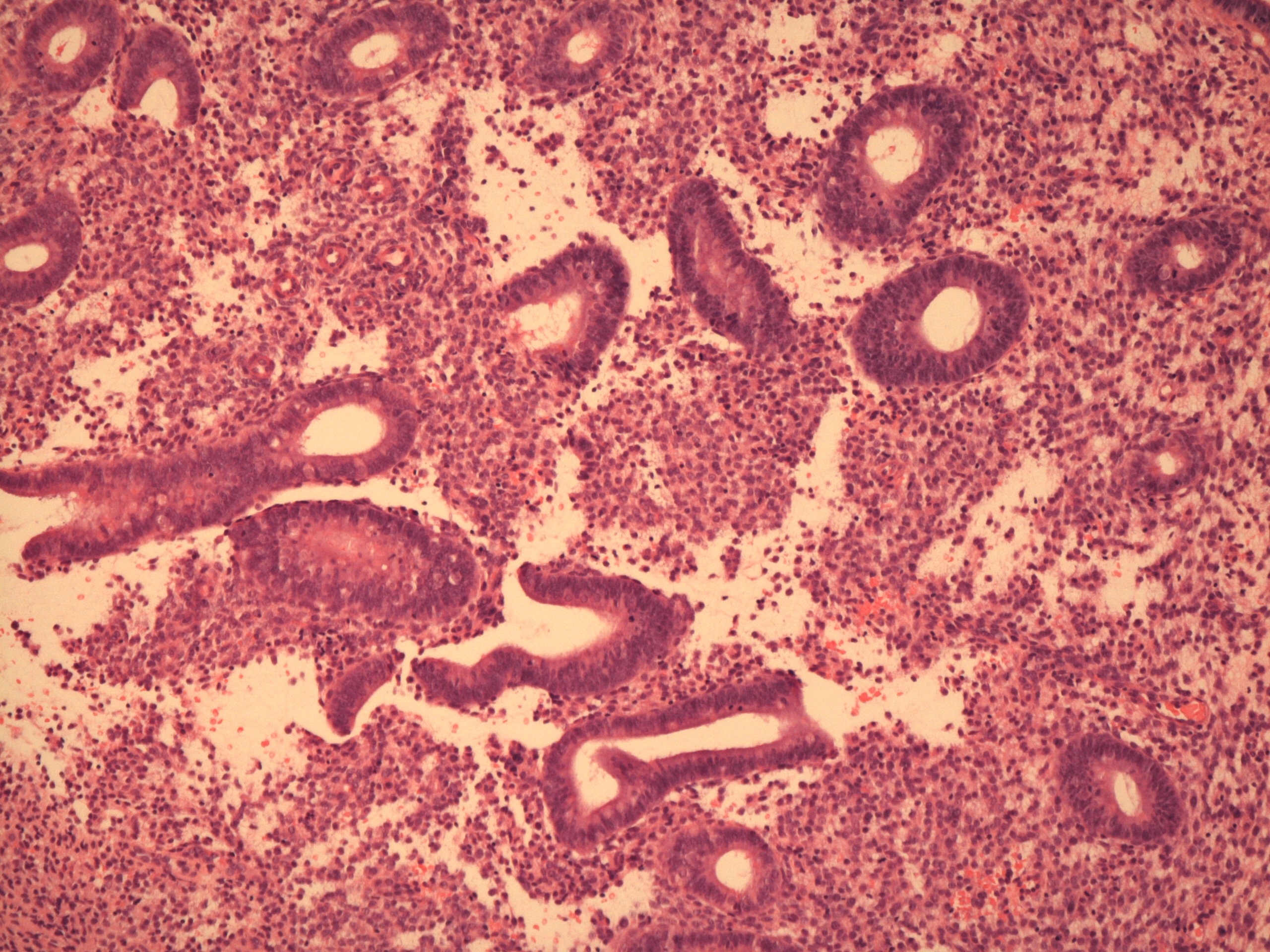 Proliferative endometrium