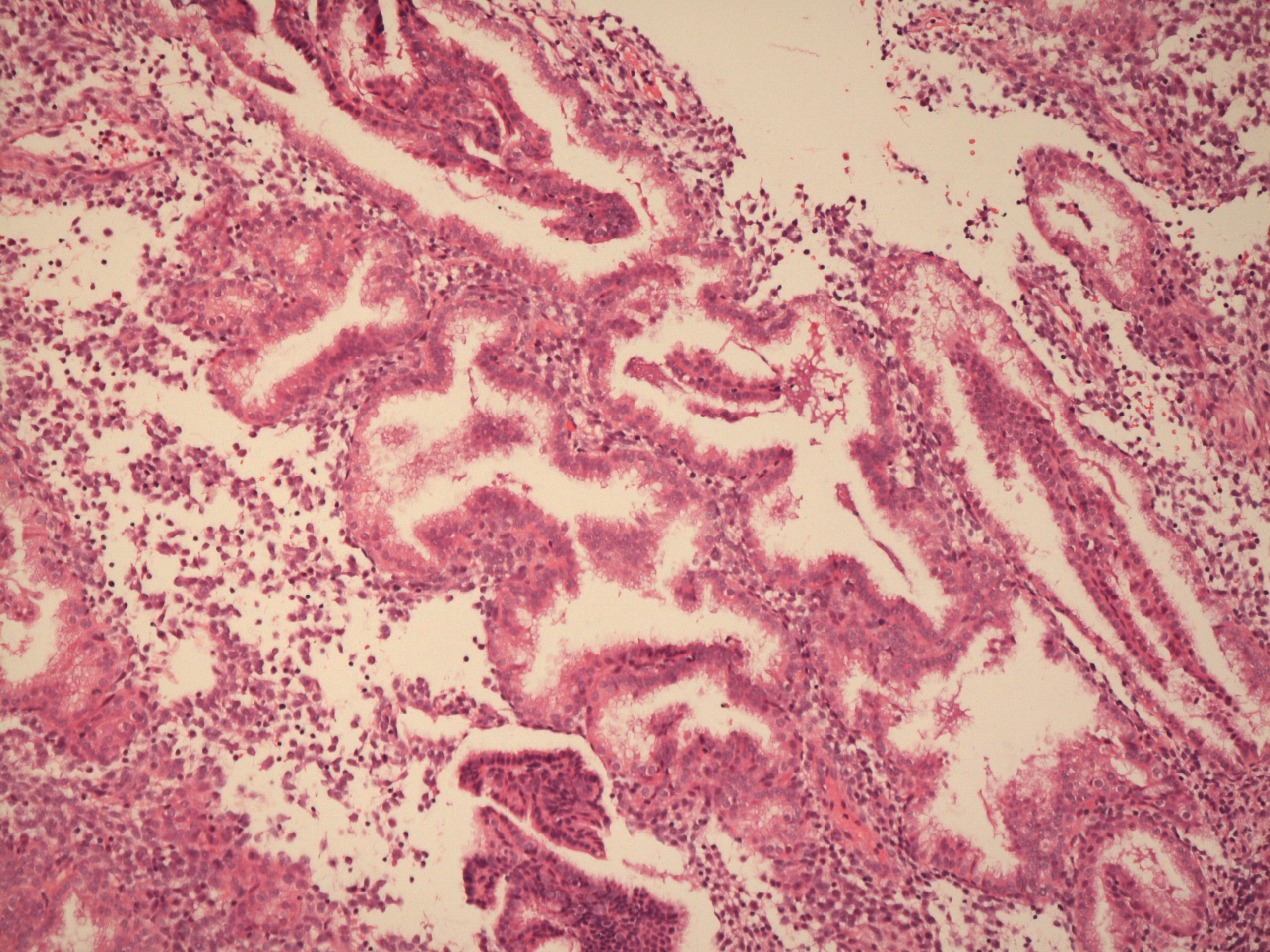 Secretory endometrium