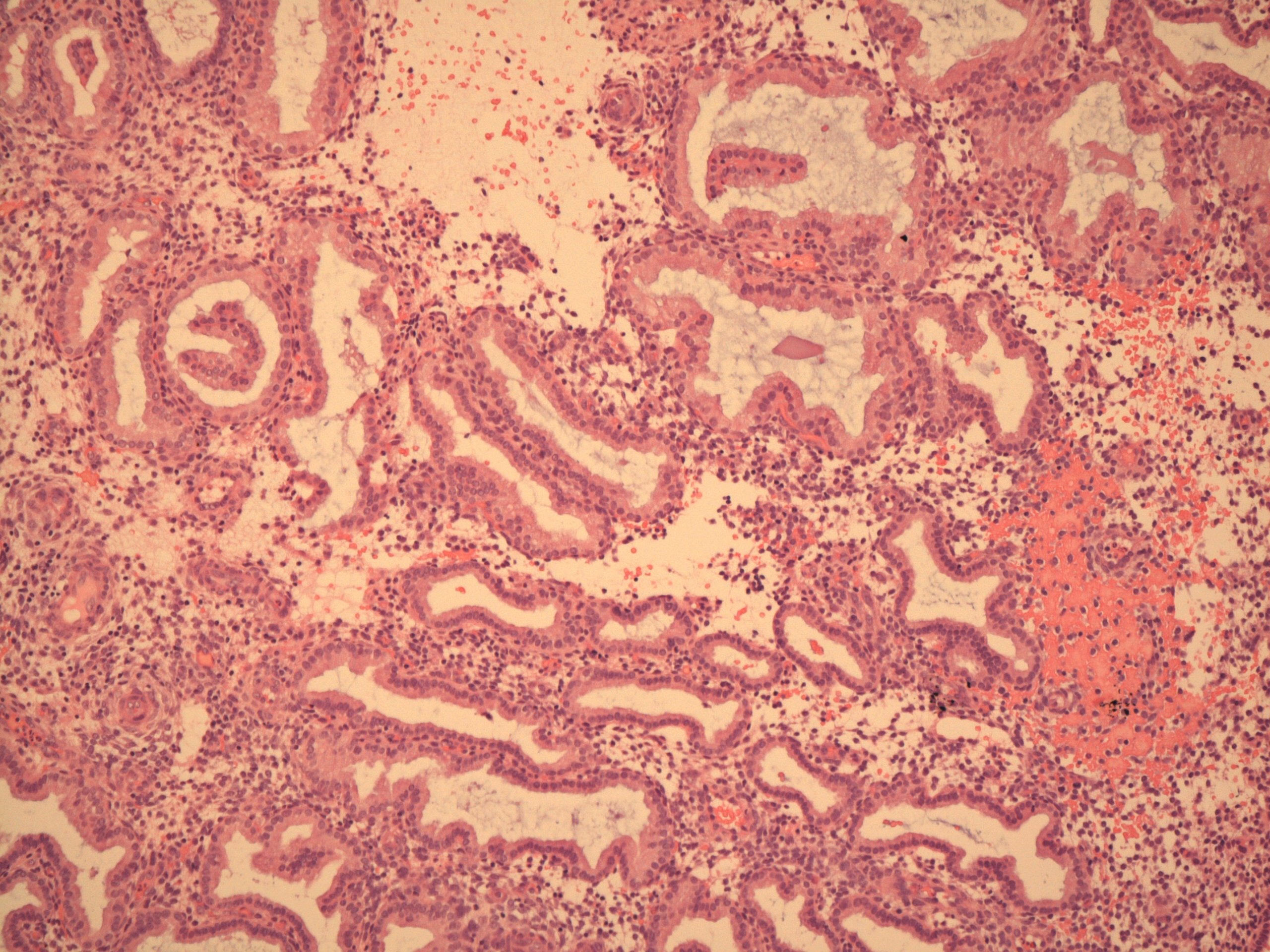 Secretory Endometrium