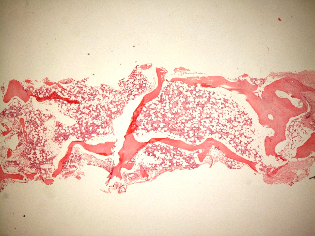 Bone marrow