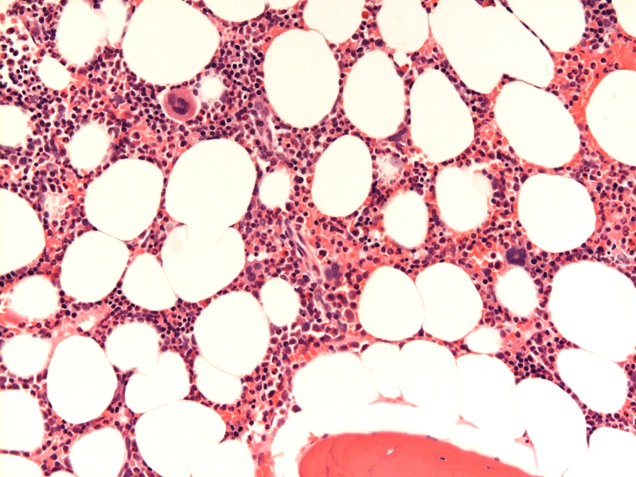Bone marrow