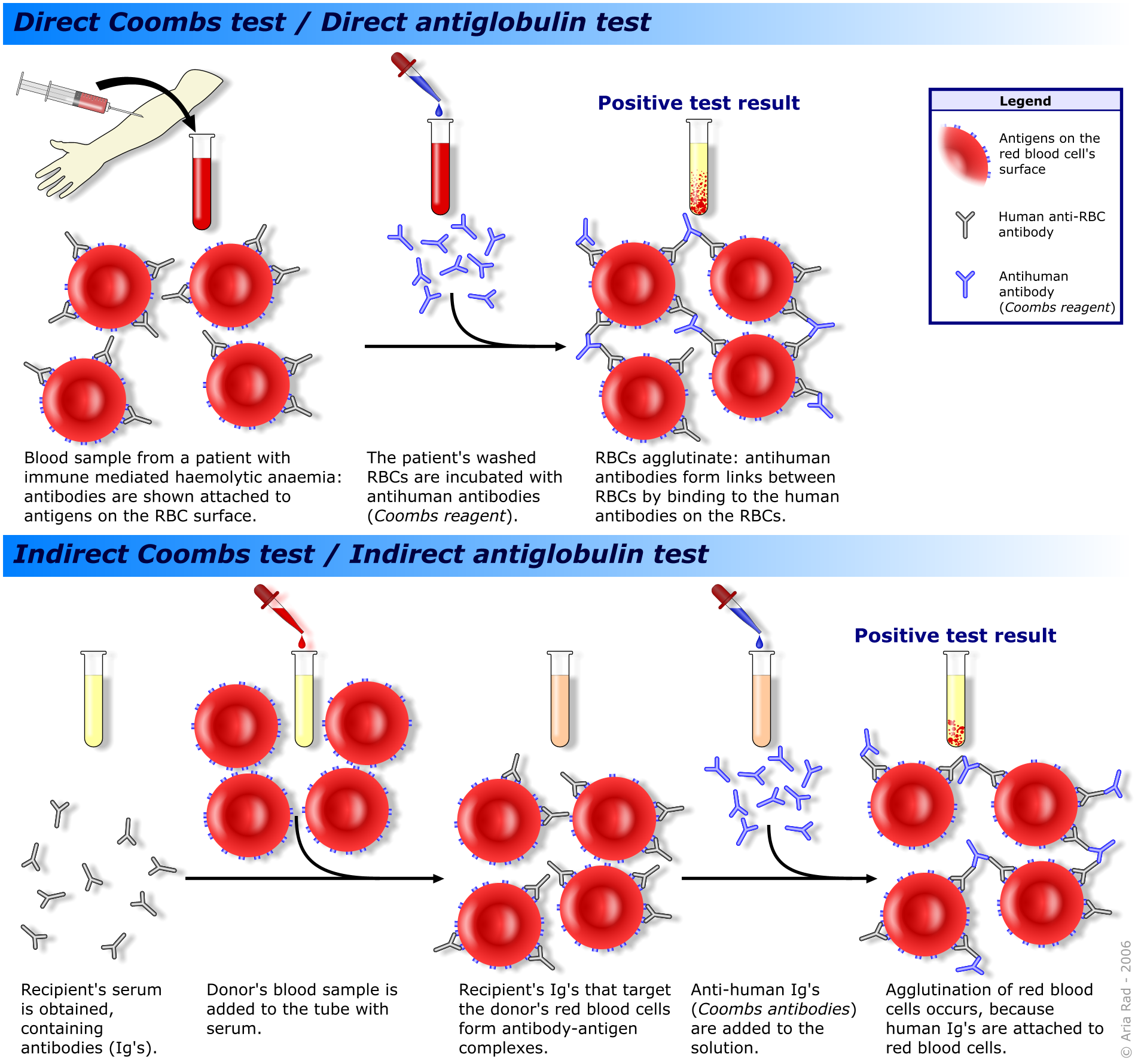 Coombs Test