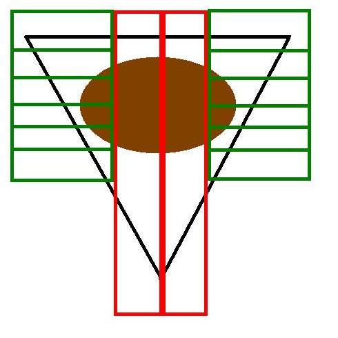 Diagram of a skin wedge